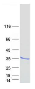 SDS-PAGE (SOCS3-1315H).jpg